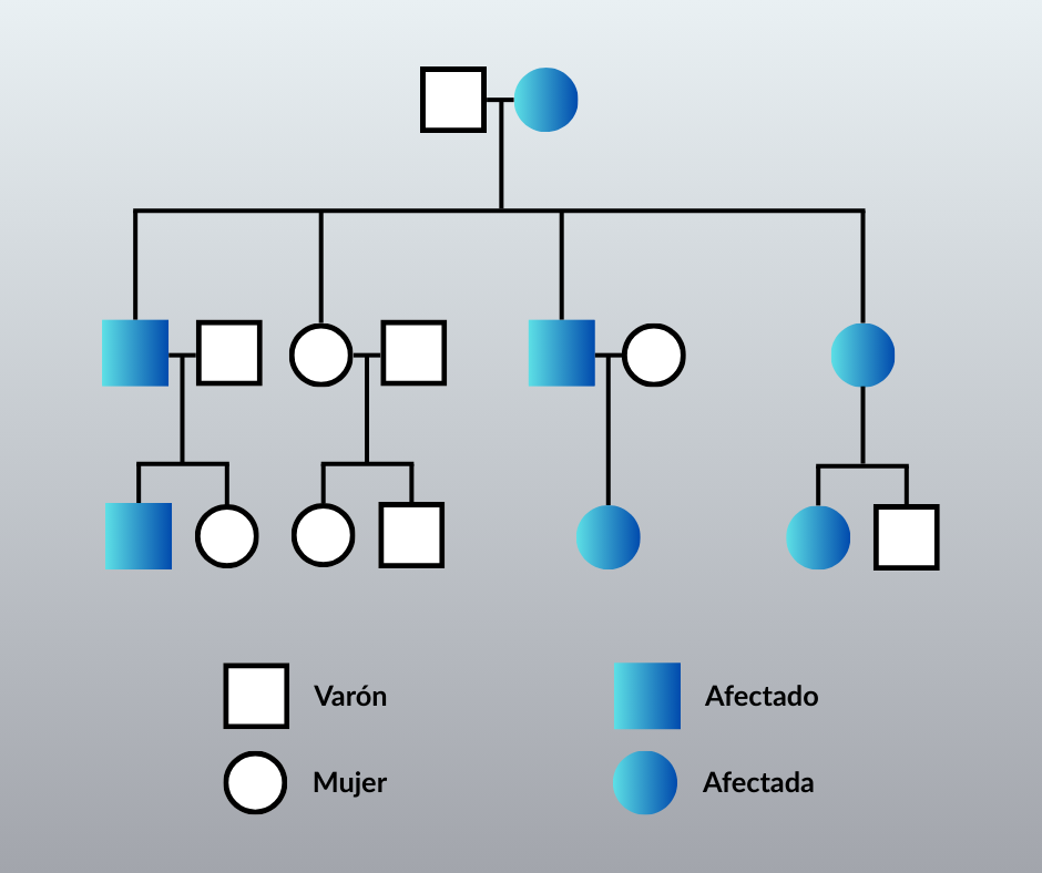 Ejemplo de genograma en una familia afectada por Enfermedad de Alzheimer familiar: varios familiares afectados en más de una generación.